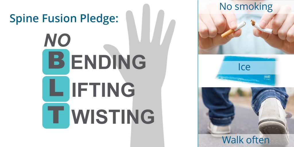 spine fusion pledge: no bending, lifting or twisting