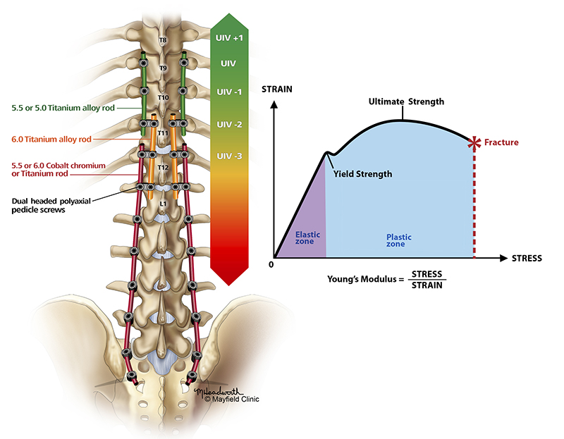 Mayfield Brain & Spinal Column